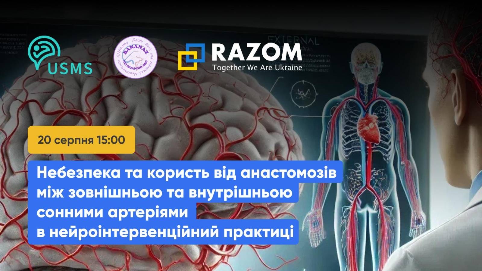 Небезпека та користь від анастомозів між зовнішньою та внутрішньою сонними артеріями в нейроінтервенційній практиці