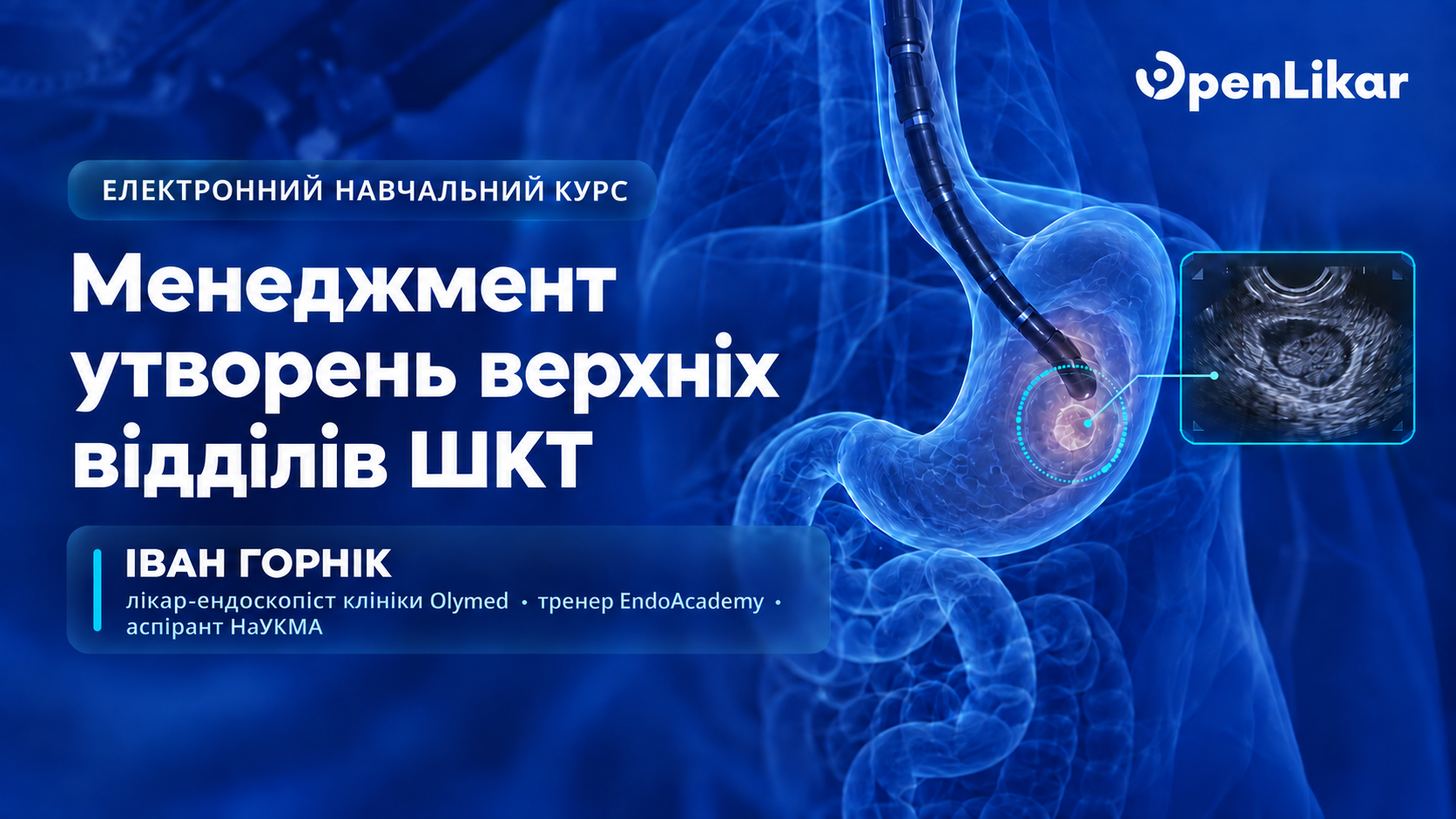 Електронний навчальний курс «Менеджмент утворень верхніх відділів ШКТ»