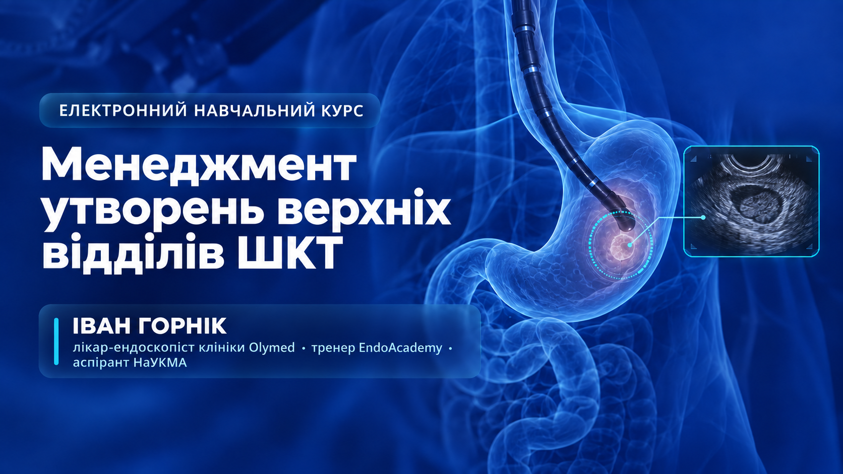 Електронний навчальний курс «Менеджмент утворень верхніх відділів ШКТ»